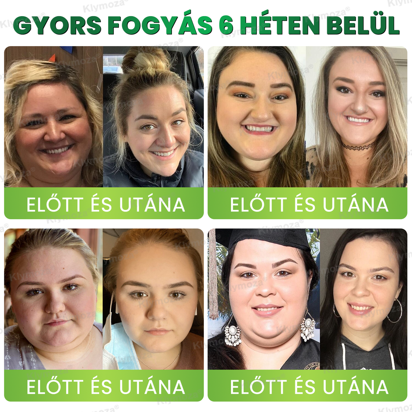 Klymoza® GLP-1 BioMetabolikus Cseppek – Élelmiszeripari zsírégető – a Magyar Elhízástudományi Társaság (HSSO) fejlesztésében