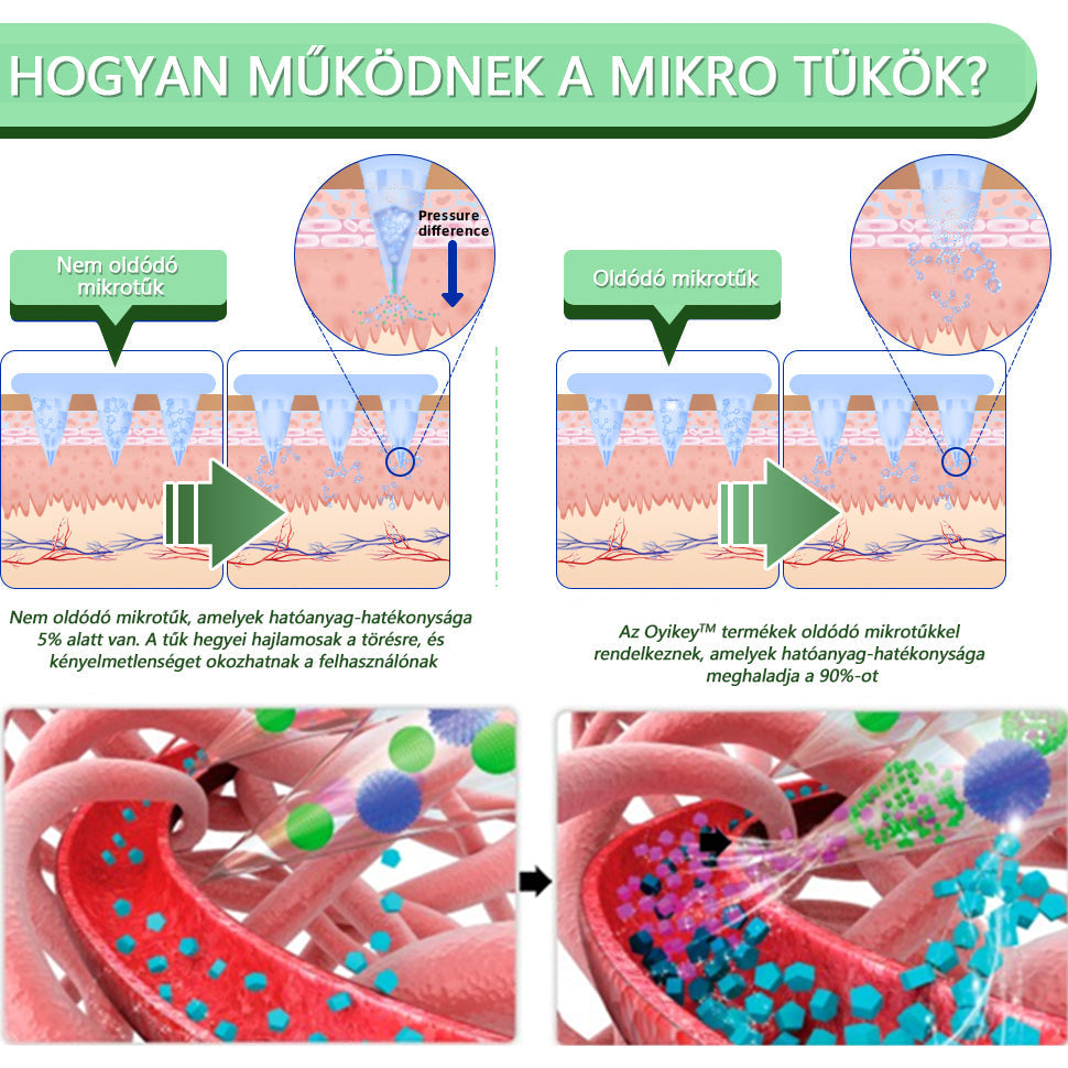 𝐕𝐨𝐢𝐥𝐚𝐢𝐬𝐭® SMGT-GLP-1 nano mikrotűs tapasz – a Magyar Elhízástudományi Társaság (HSSO) fejlesztésében