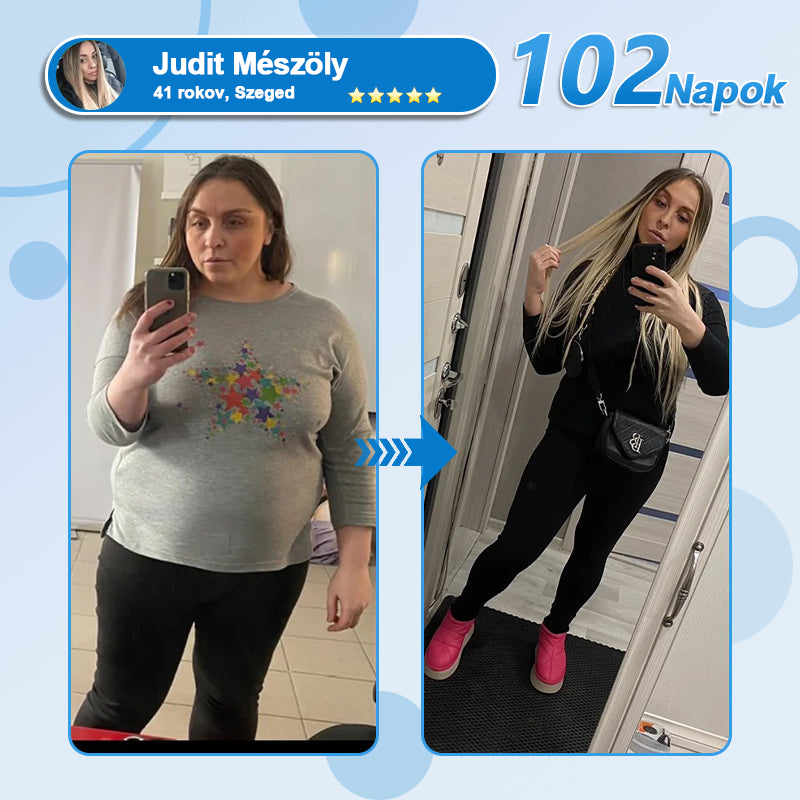 FormaÉlet® Nano Mikrotű Tapasz SMGT-GLP-1-tel és Matrixyl 3000-rel – Fogyás, Bőrfeszesítés, Vércukorszint-támogatás, Injekció Nélkül, 7 Napos Eredmény