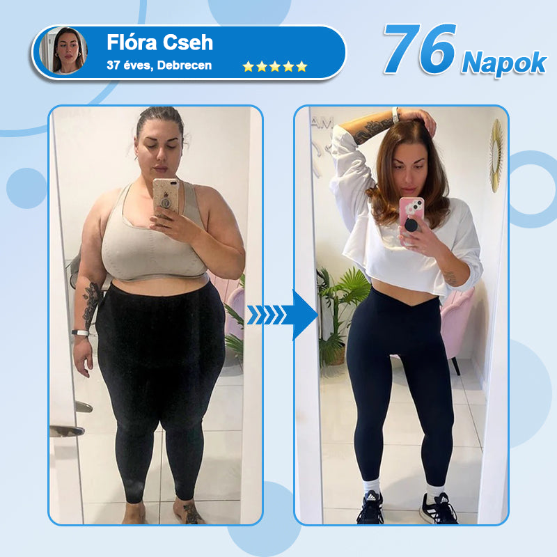 FormaÉlet® Nano Mikrotű Tapasz SMGT-GLP-1-tel és Matrixyl 3000-rel – Fogyás, Bőrfeszesítés, Vércukorszint-támogatás, Injekció Nélkül, 7 Napos Eredmény