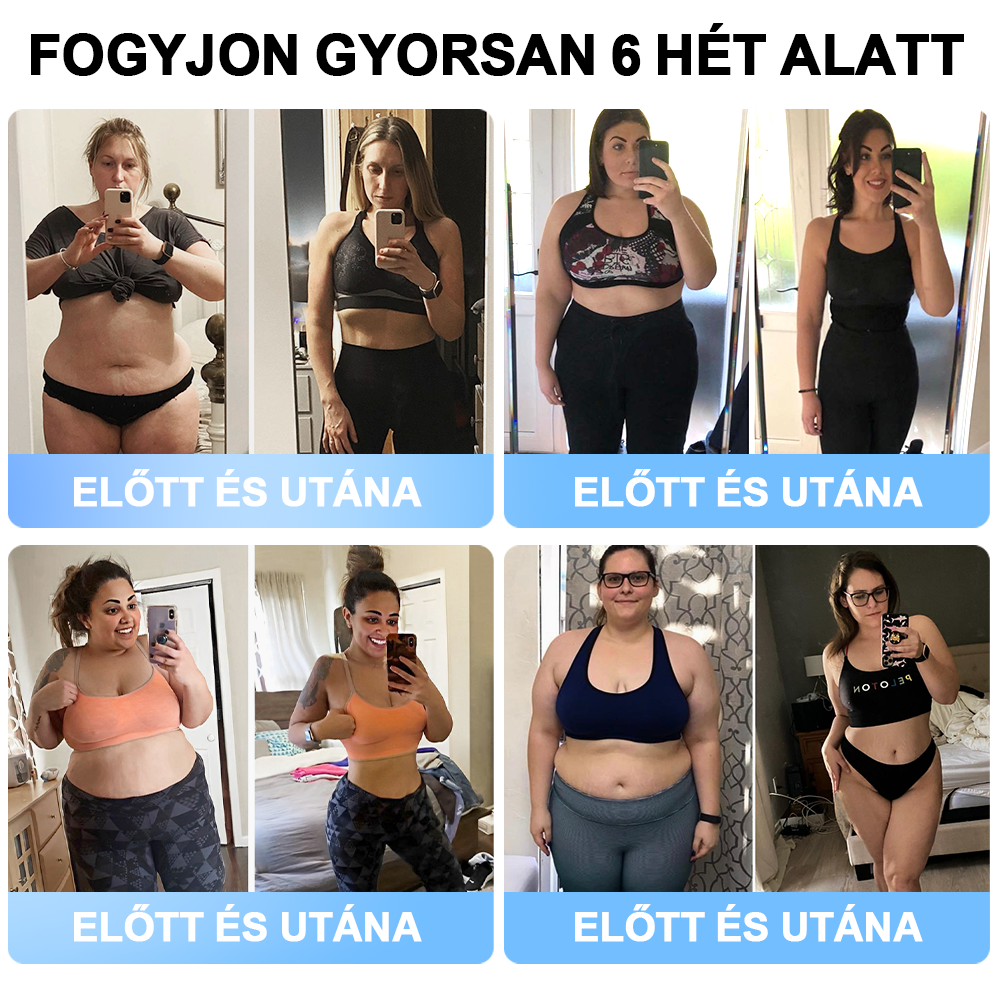 FormaÉlet® Nano Mikrotű Tapasz SMGT-GLP-1-tel és Matrixyl 3000-rel – Fogyás, Bőrfeszesítés, Vércukorszint-támogatás, Injekció Nélkül, 7 Napos Eredmény