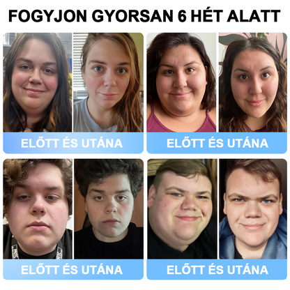 FormaÉlet® Nano Mikrotű Tapasz SMGT-GLP-1-tel és Matrixyl 3000-rel – Fogyás, Bőrfeszesítés, Vércukorszint-támogatás, Injekció Nélkül, 7 Napos Eredmény