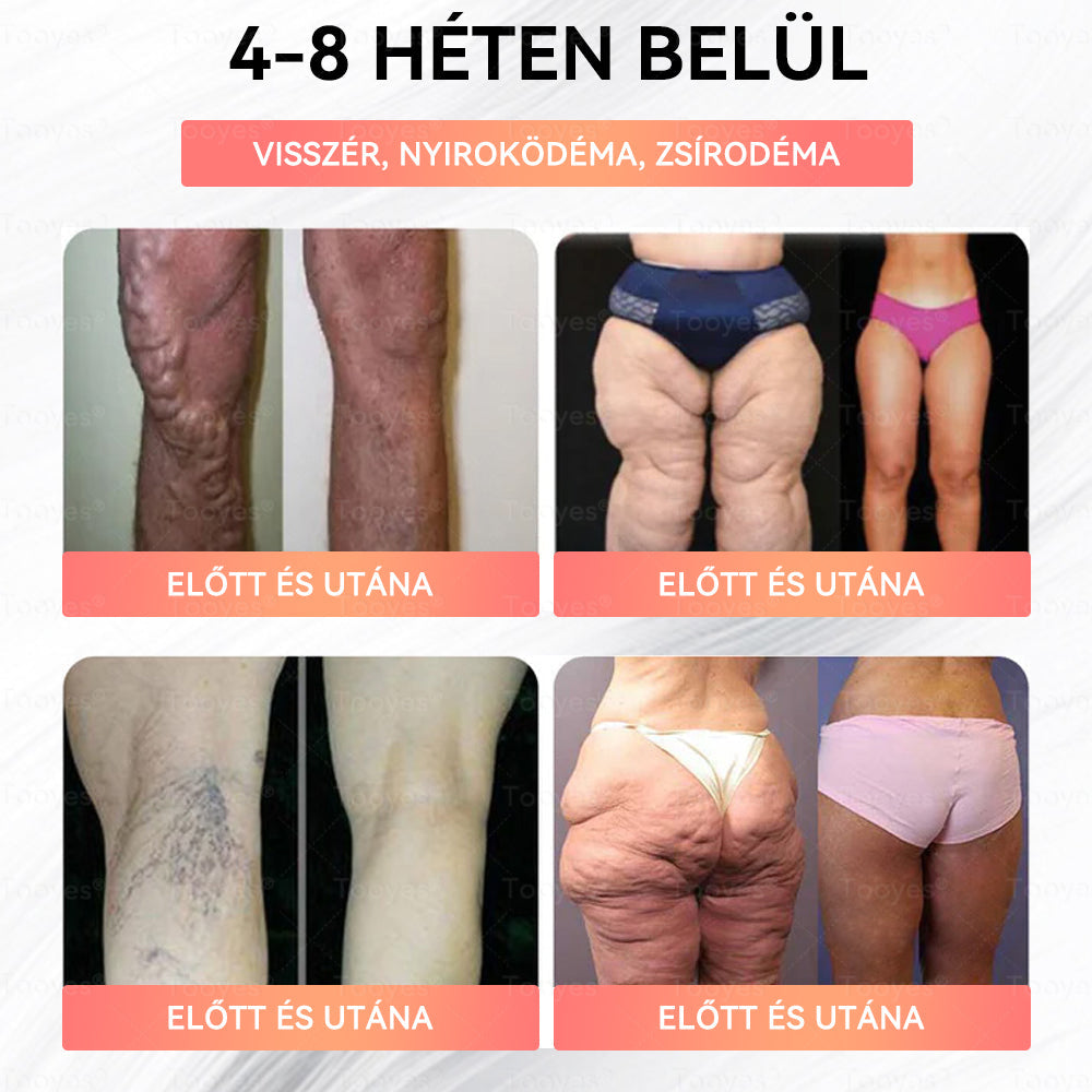 Hivatalos webáruház – ⚡Tooyes® GLP-1 Magas Koncentrációjú Folyékony Gyöngyök – NAD+, Moringa, HCA összetevőkkel (Fogyás, Öregedésgátlás, Bél- és Immunrendszer támogatás, Vércukorszint egyensúly, Szív- és Agyegészség)